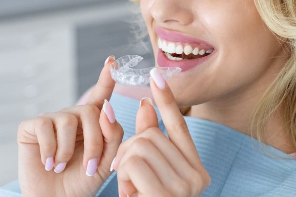 Banner for invisalign orthodontics, modern dentistry concept. Unrecognizable blonde woman with healthy white teeth holding invisible braces while sitting at dental chair, closeup portrait, copy space